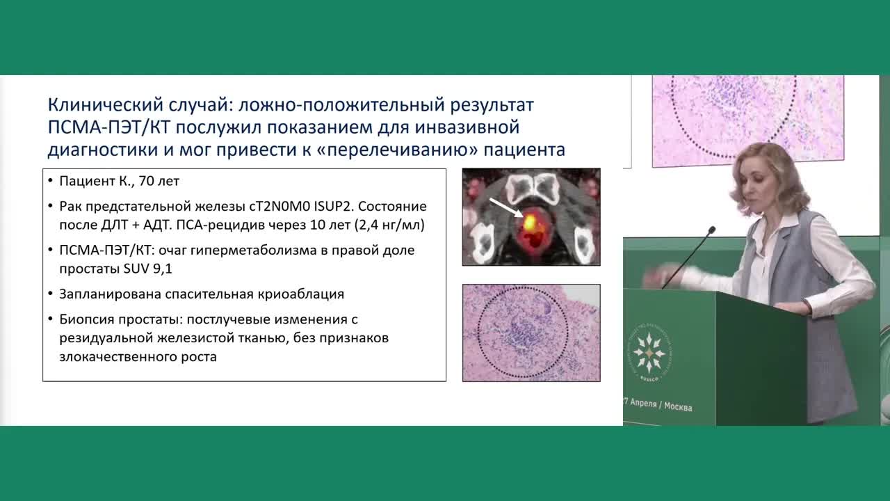 Оптимальный объем обследования при биохимическом рецидиве рака предстательной железы