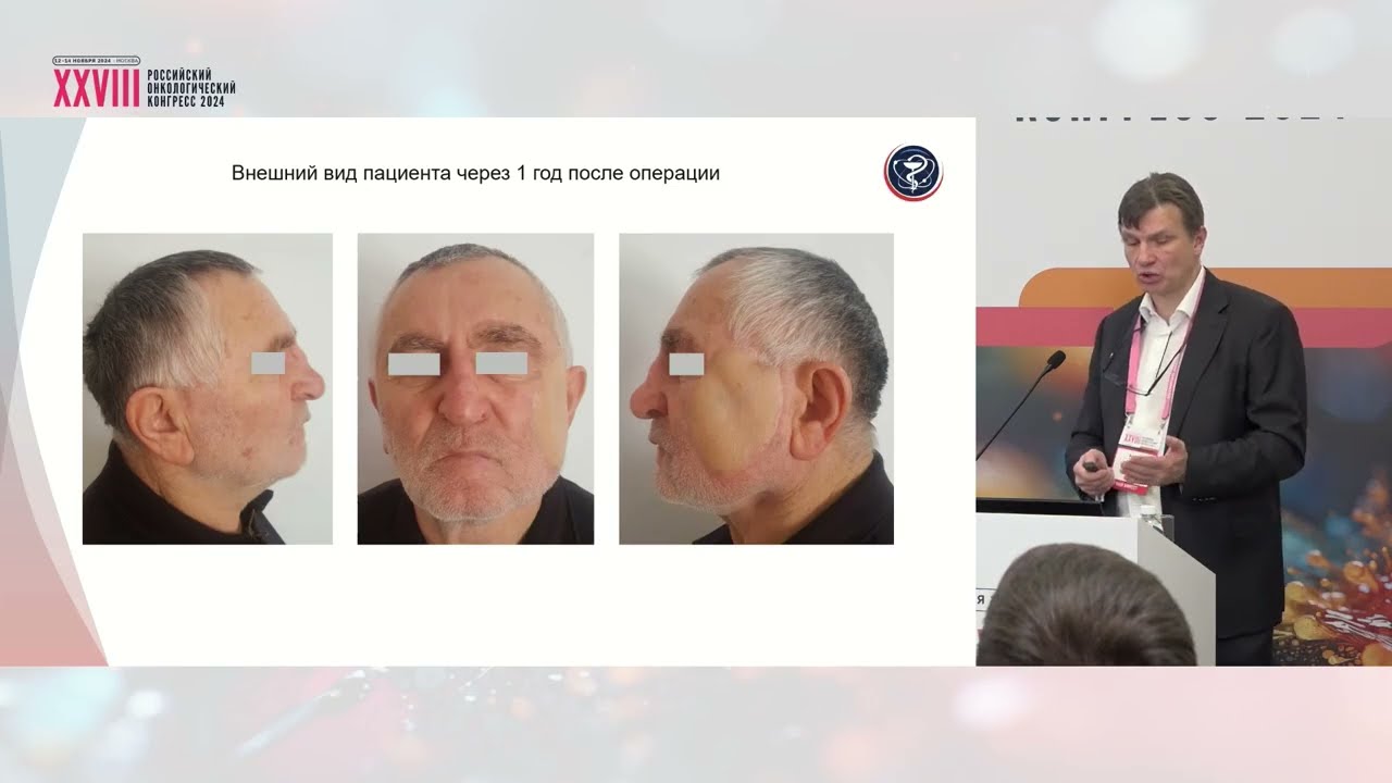 Реконструктивно-восстановительная хирургия в онкологии