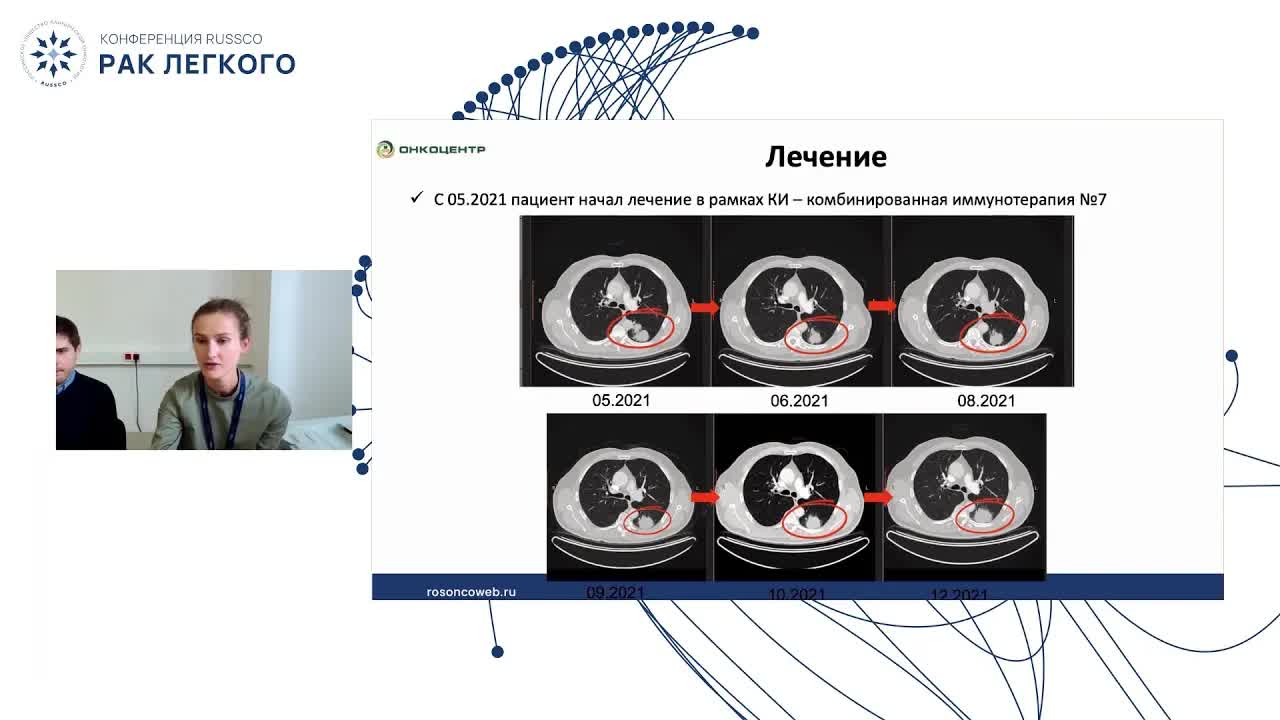 Локализованный рак легкого. Клинический случай 1