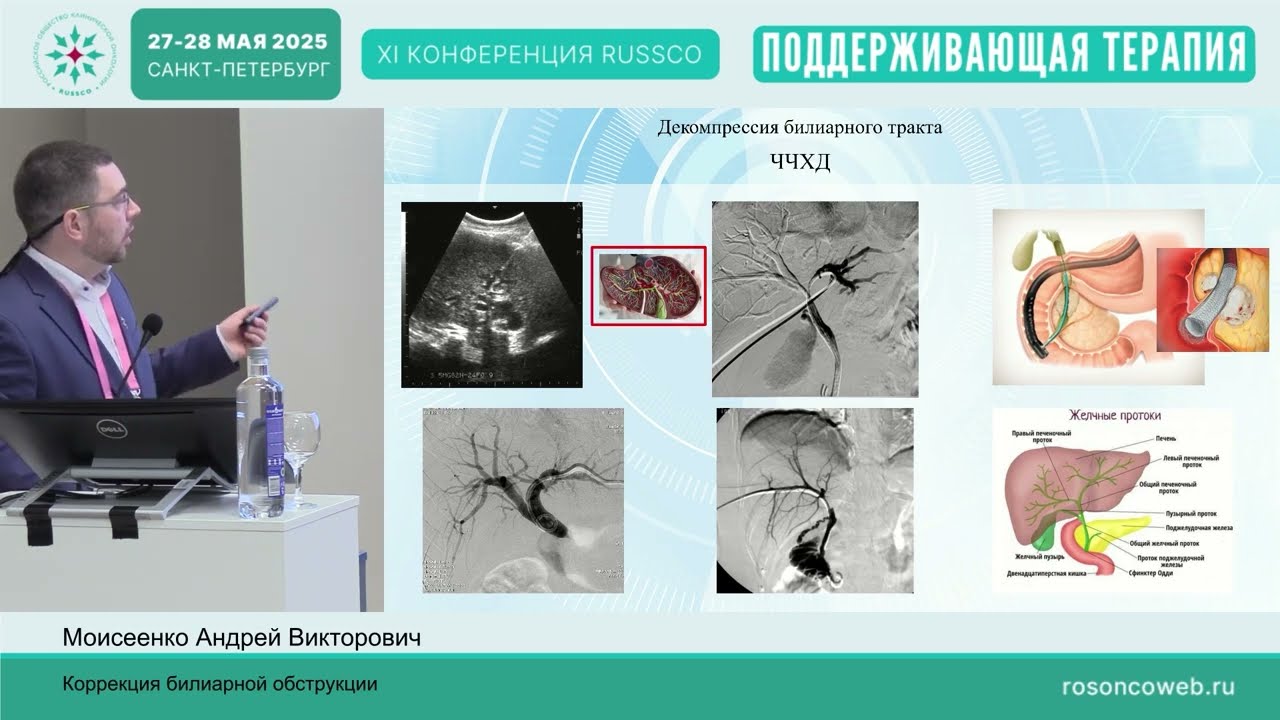 Коррекция билиарной обструкции