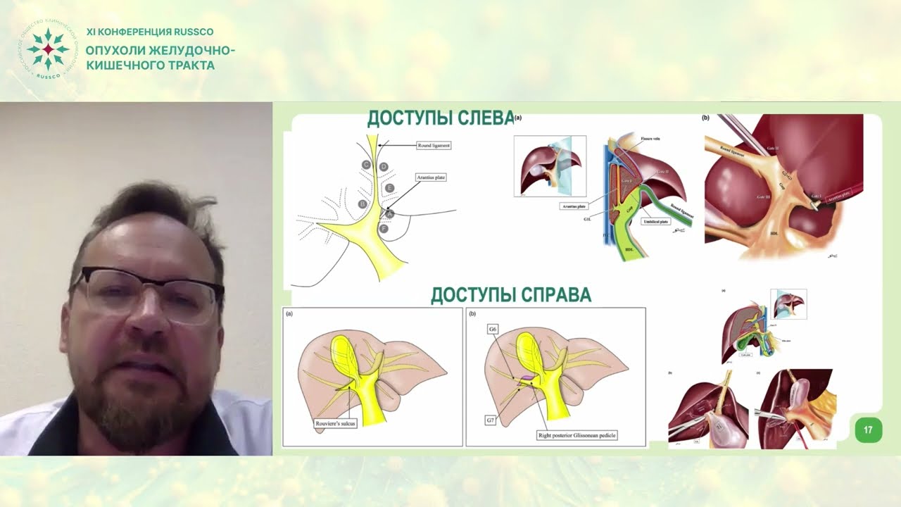 Преимущество различных вариантов техник резекций печени