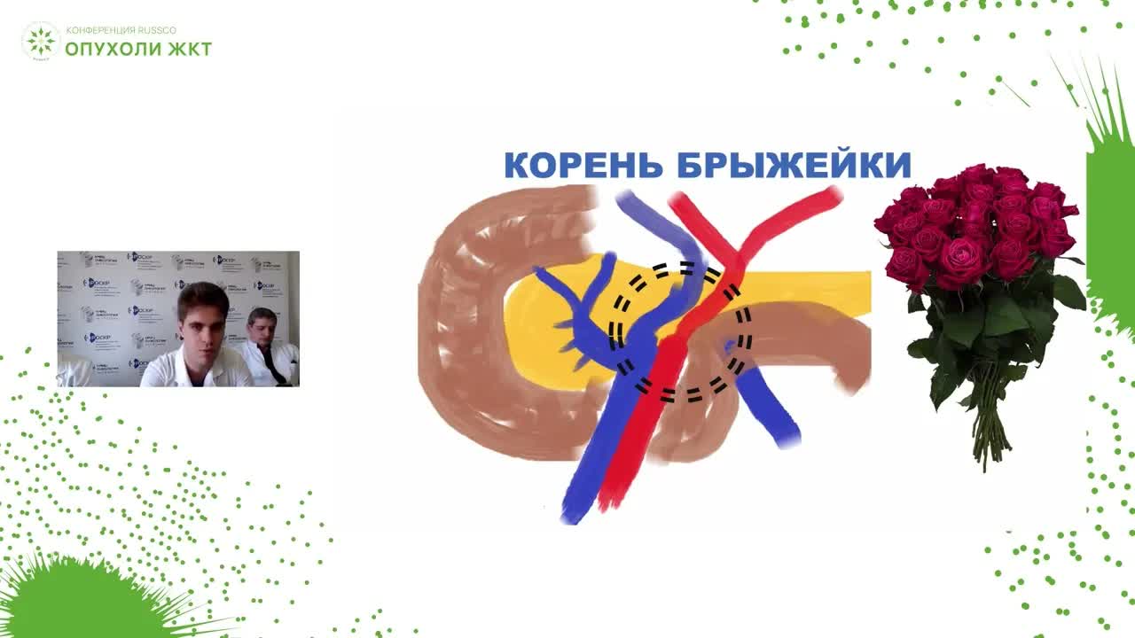Малоинвазивная хирургия при раке ободочной кишки – от анатомии до технических приемов
