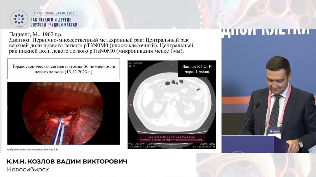 Паренхимосберегающая операция в лечении первично-множественного метахронного рака легкого