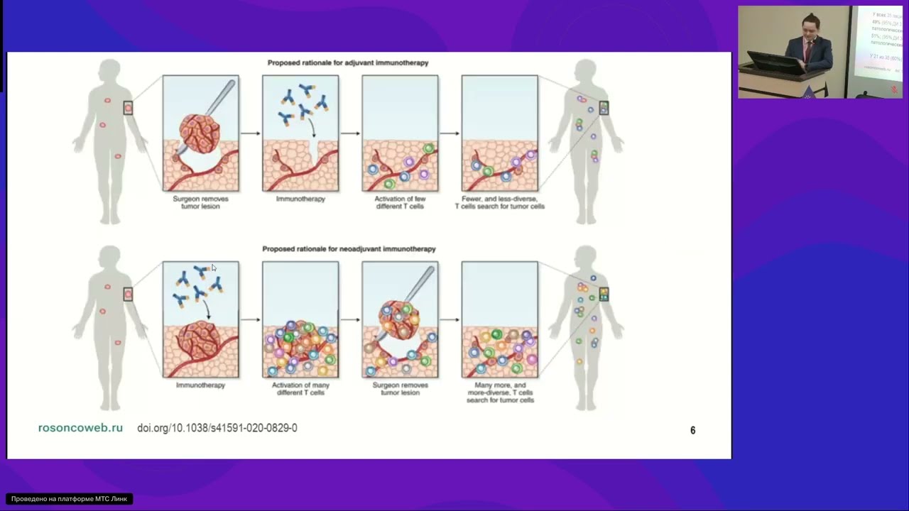 Неоадъювантная терапия меланомы: от перестановки слагаемых сумма меняется?