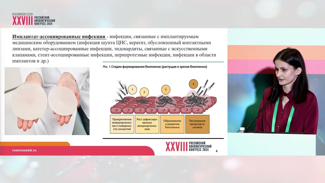 Инфекционные осложнения после реконструктивных операций у больных раком молочной железы