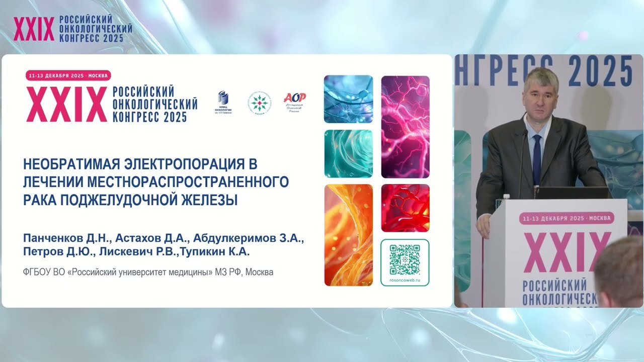 Необратимая электропорация в лечении местнораспространенного рака поджелудочной железы