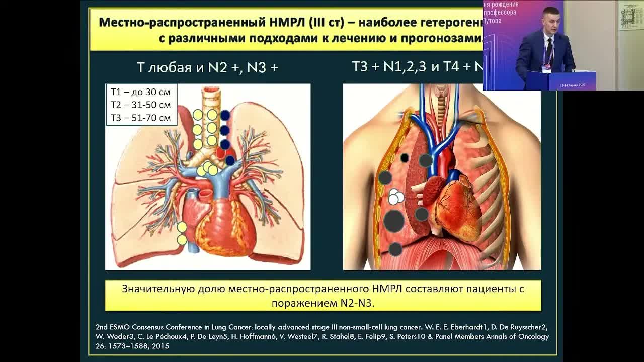 Хирургия местнораспространенного немелкоклеточного рака легкого в эпоху возможностей «нехирургии»