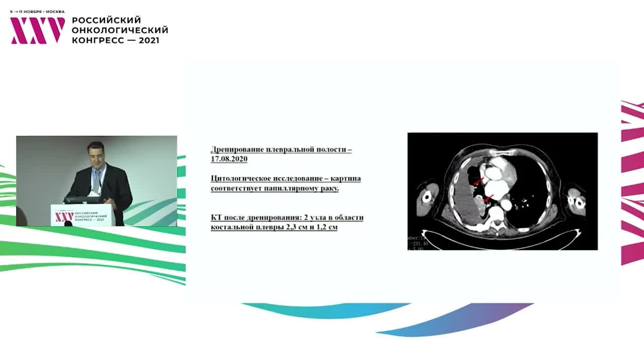 Таргетная терапия радиойодрефрактерного рака щитовидной железы. Современные возможности продлить жизнь