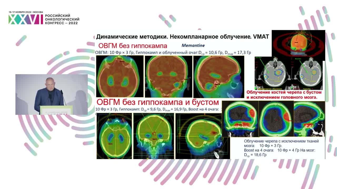 Современные тенденции в радиохирургии при метастатическом поражении головного мозга