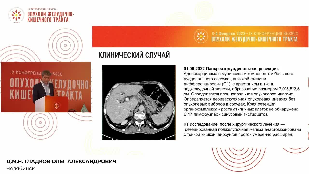 Разбор клинических наблюдений: рак Фатерова сосочка