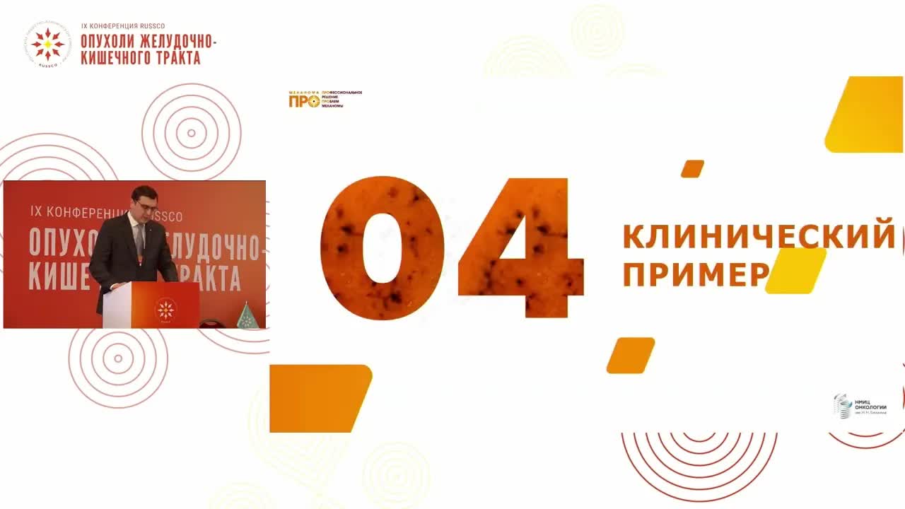 Разбор клинических наблюдений: меланома прямой кишки