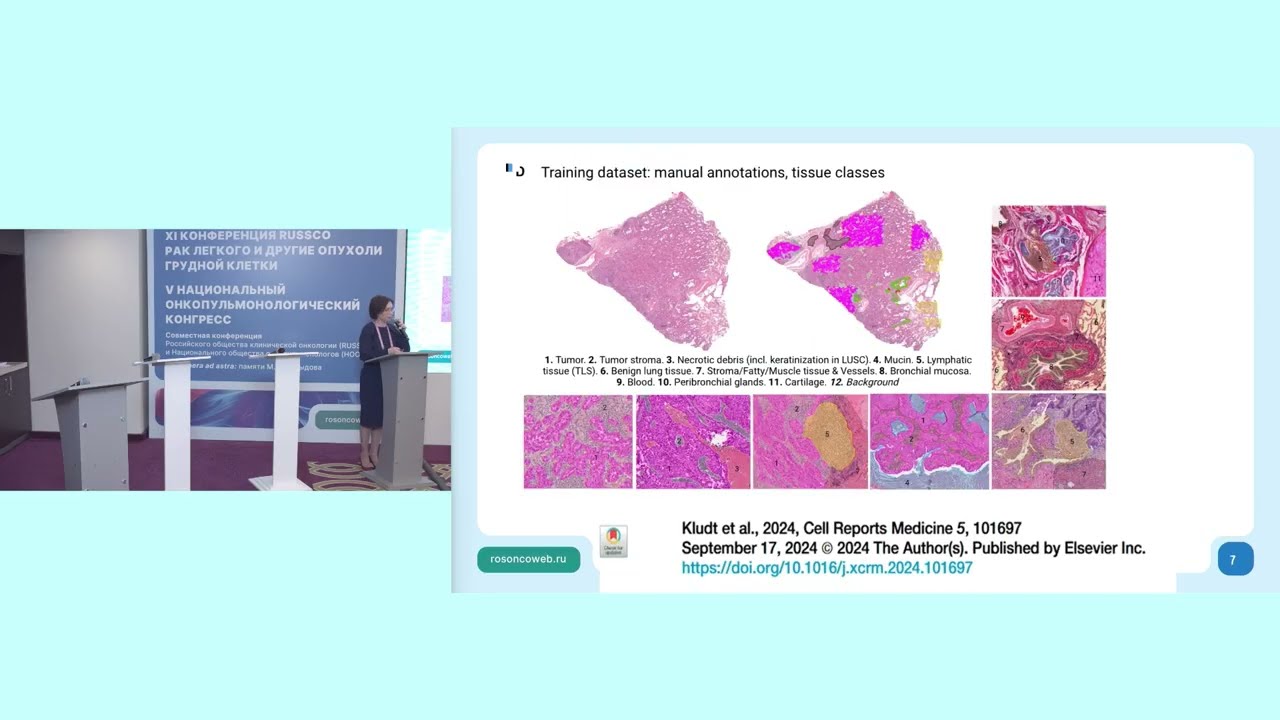 Соревнование профессий. Интерактивная сессия по раку легкого