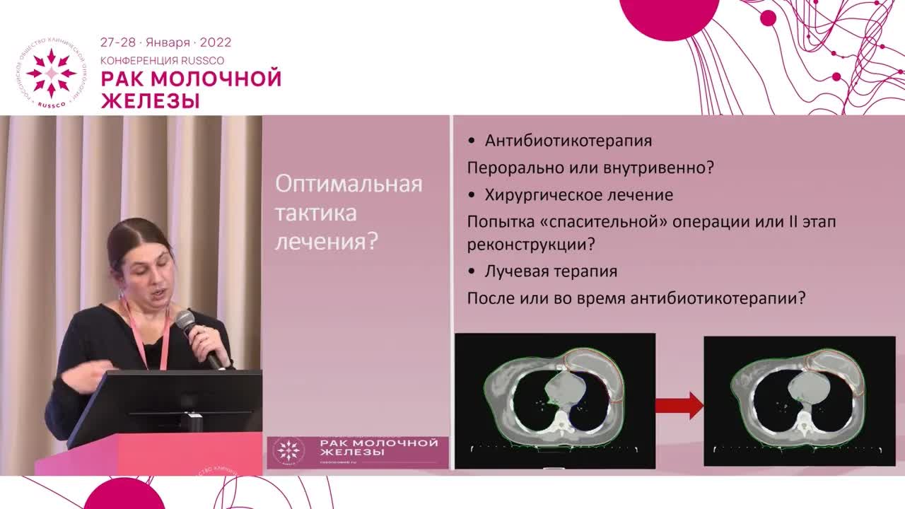 Потеря эспандера после лучевой терапии РМЖ: хирургический брак, осложнения лучевой терапии или закономерность? Разбор клинического случая