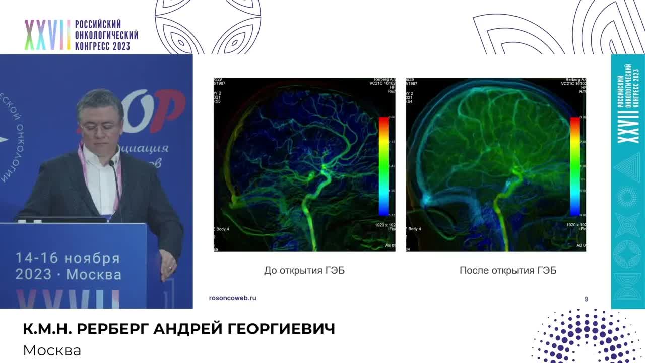 Регионарное лечение пациентов с глиобластомой G4: первый клинический опыт