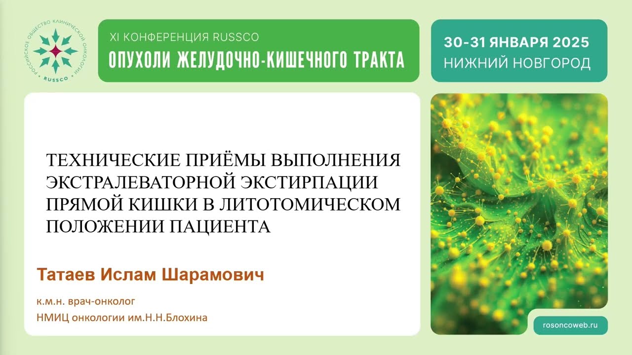 Приемы выполнения экстралеваторной экстирпации прямой кишки в литотомическом положении пациента