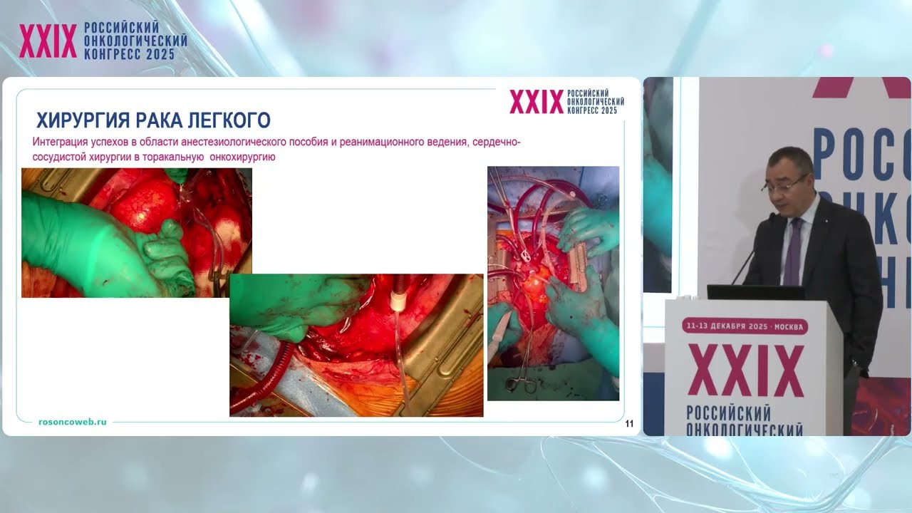 Хирургия рака легкого: новые горизонты и возможности
