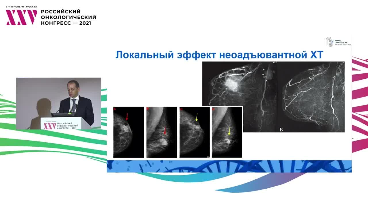 Деэскалация хирургического вмешательства у больных ранним РМЖ, достигших полного патоморфологического ответа NCT04293796. Рецензент