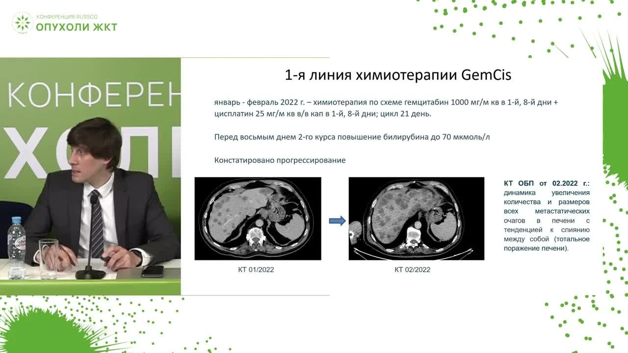 Разбор клинических наблюдений: холангиоцеллюлярный рак