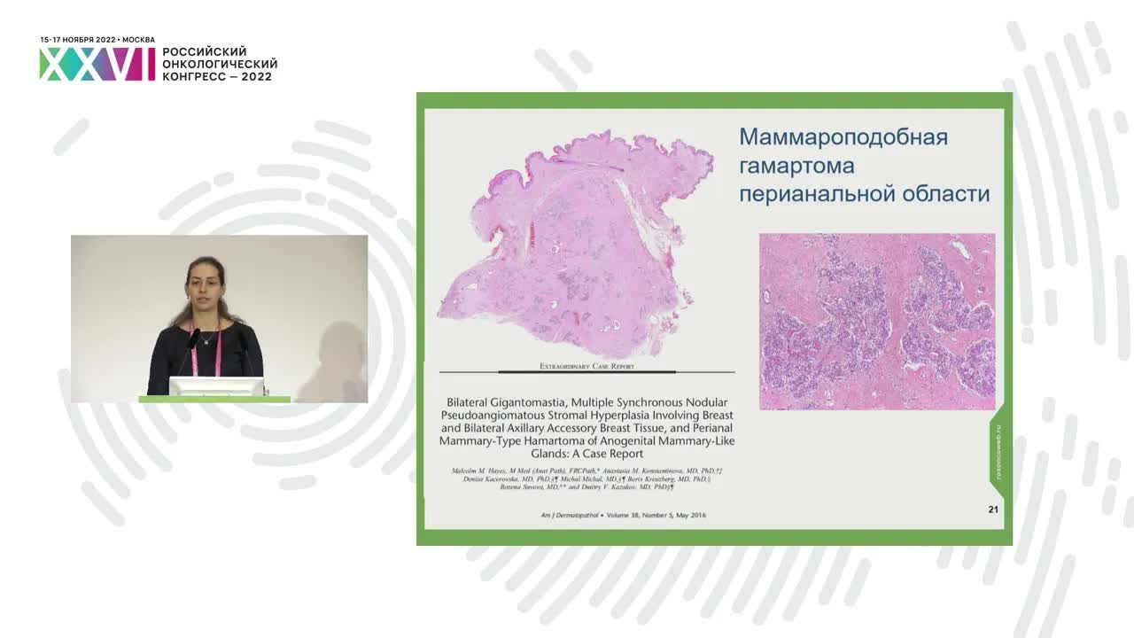 Морфологические особенности и трудности диагностики опухолей аногенитальных маммароподобных желез