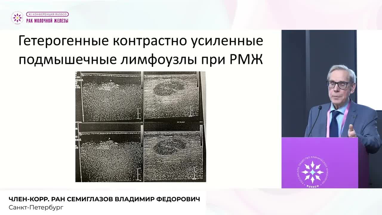 Эволюция/революция лечения РМЖ