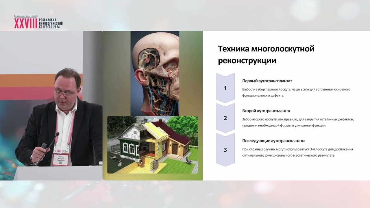 Особенности микрохирургической реконструкции органов головы и шеи с несколькими аутотрансплантатами