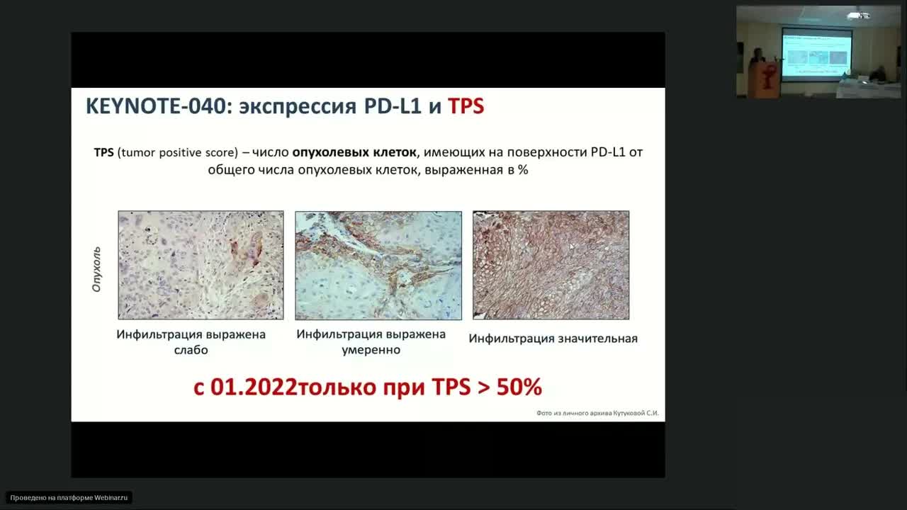 Иммунотерапия опухолей головы и шеи: надежда или разочарование