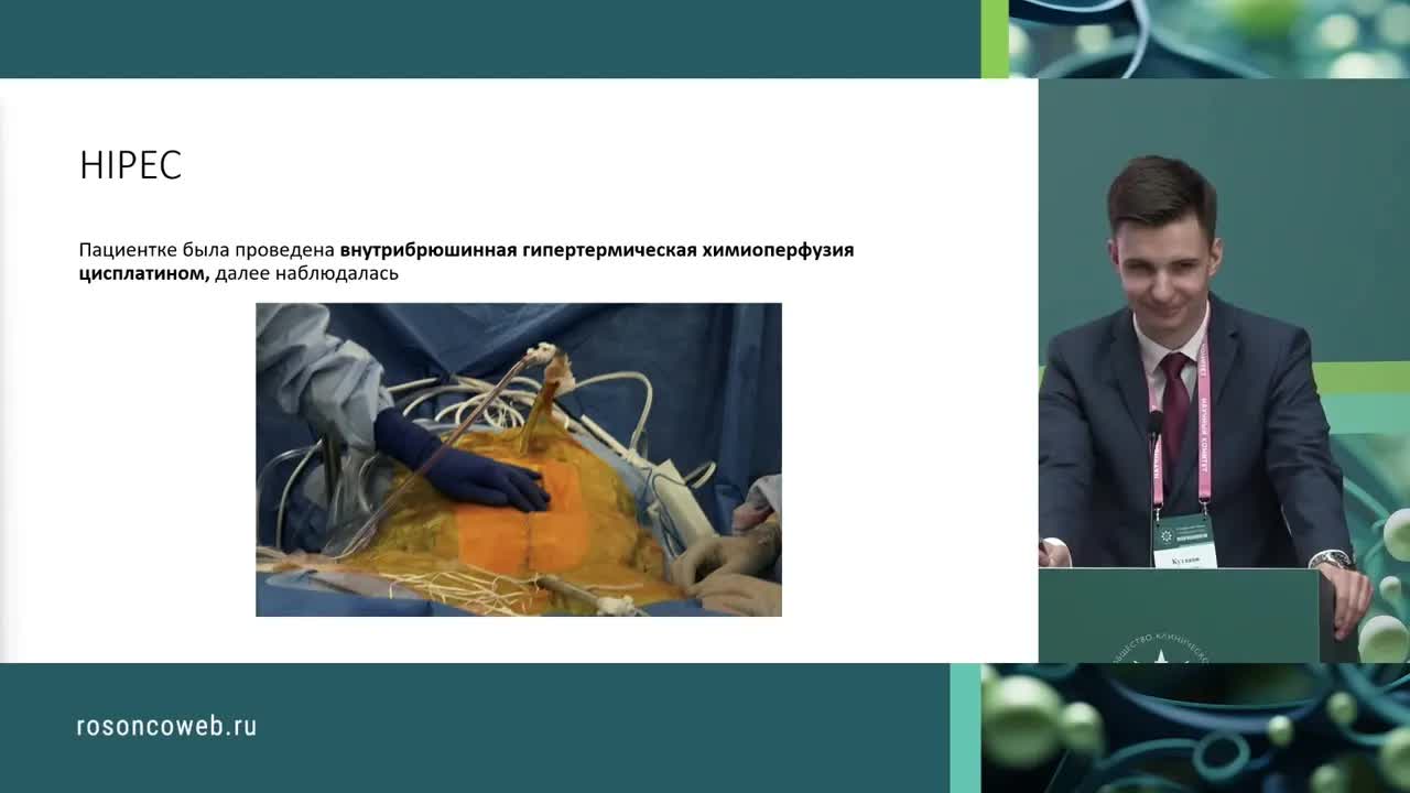 Лечение муцинозного рака яичников. Разбор клинического случая