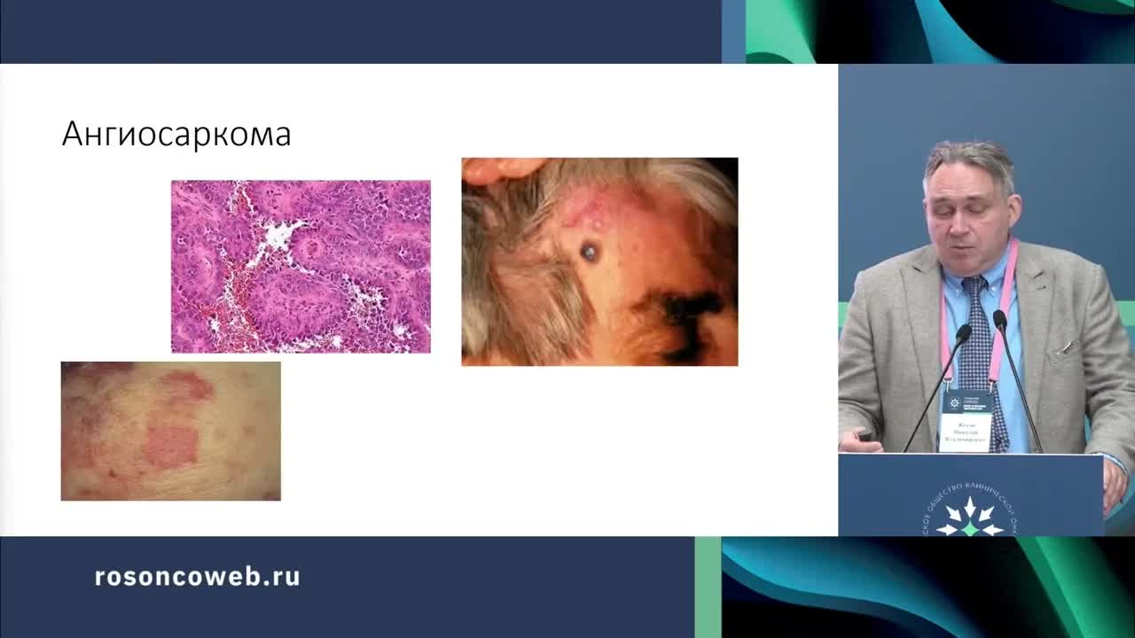 Саркомы и другие редкие опухоли: результаты ASCO 2024 и их значимость