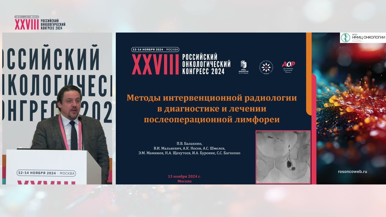 Методы интервенционной радиологии в диагностике и лечении послеоперационной лимфореи