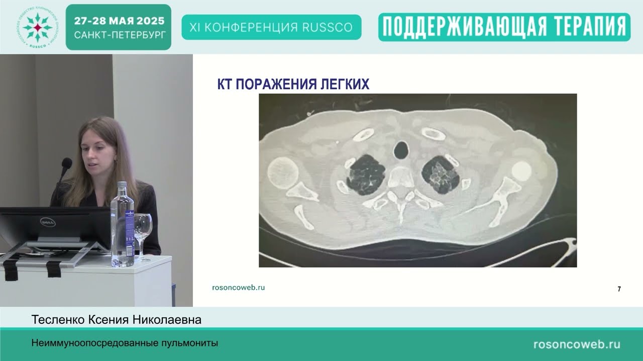 Хроническая токсичность. Неиммуноопосредованные пульмониты