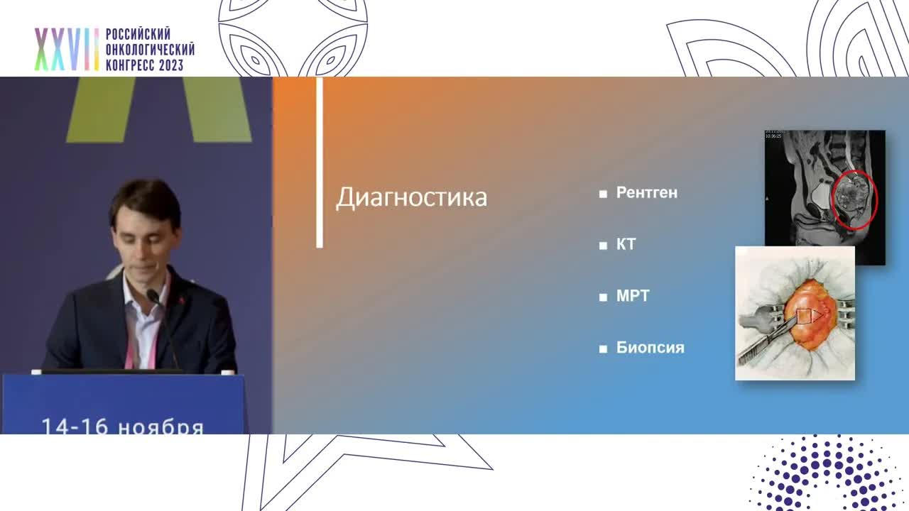 Хордома крестца: современные тенденции лечения