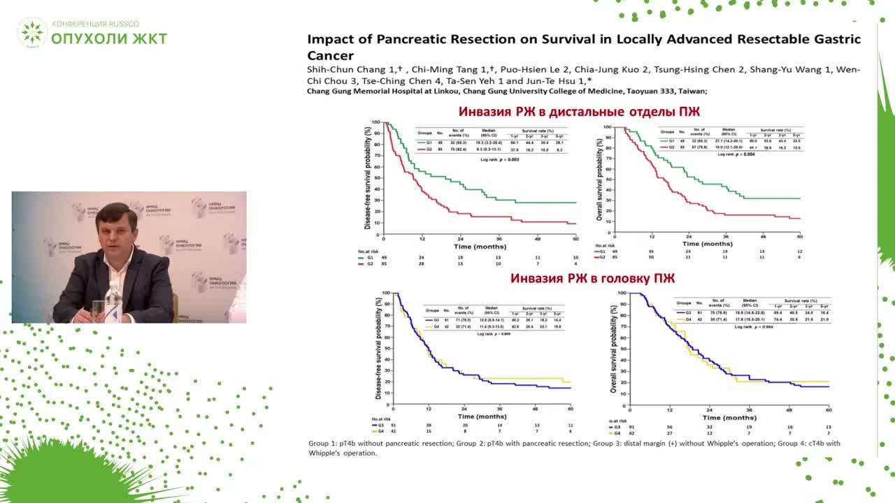 Панкреатосохранная дуоденэктомия как способ хирургического вмешательства при раке желудка с низким распространением по двенадцатиперстной кишке