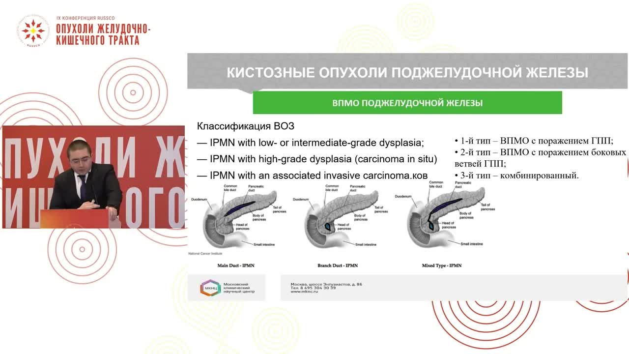 Рак поджелудочной железы