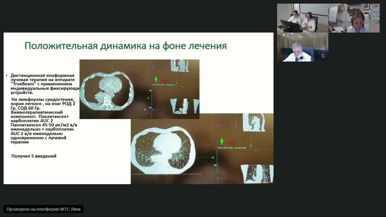 Рак легкого (вебинар 16 февраля 2024)