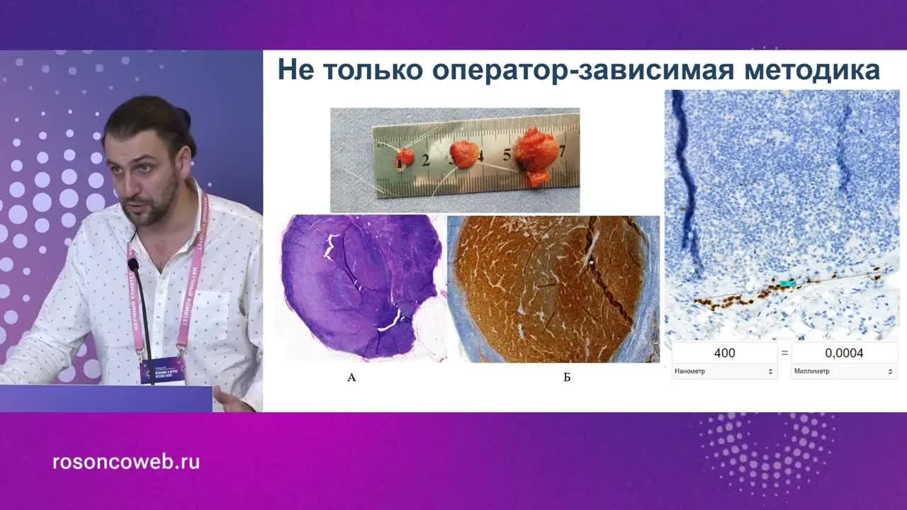 Место хирурга в лечении меланомы кожи