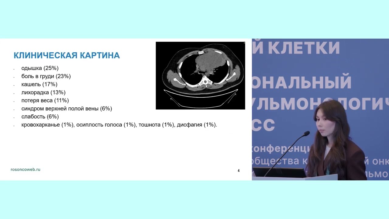 Герминогенные опухоли с поражением средостения: что может пойти не так при лечении?